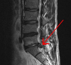 Файл:Lagehernia.png
