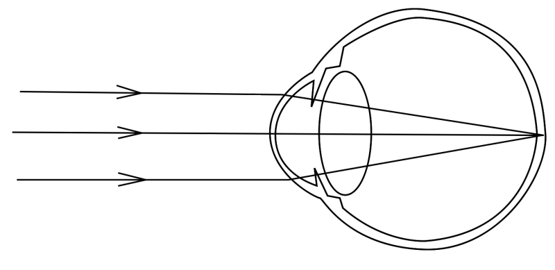 Файл:Emmetropia.png