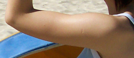 Файл:Upperarm.jpg