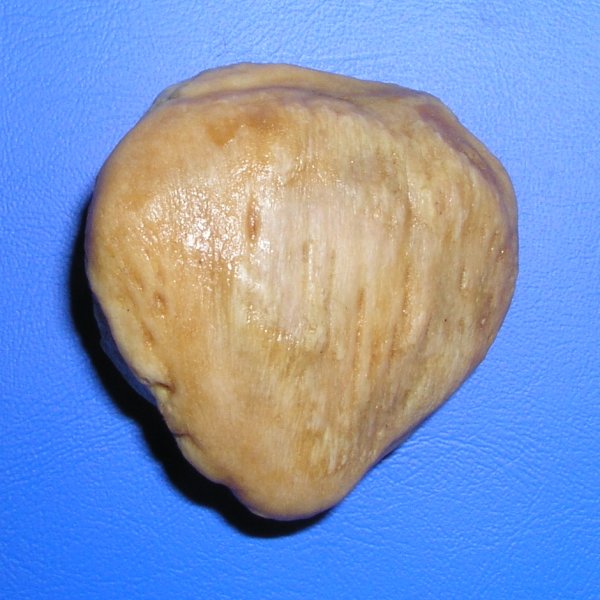 Файл:Patella ant.jpg