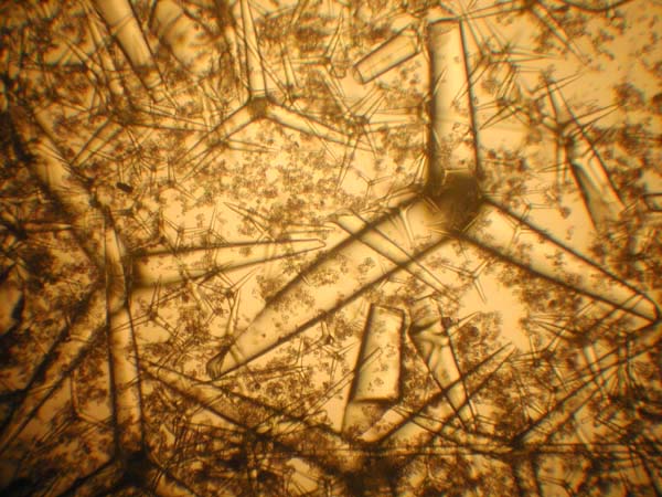 Файл:MicroscopicSpiculesfromPachastrellidSponge.jpg