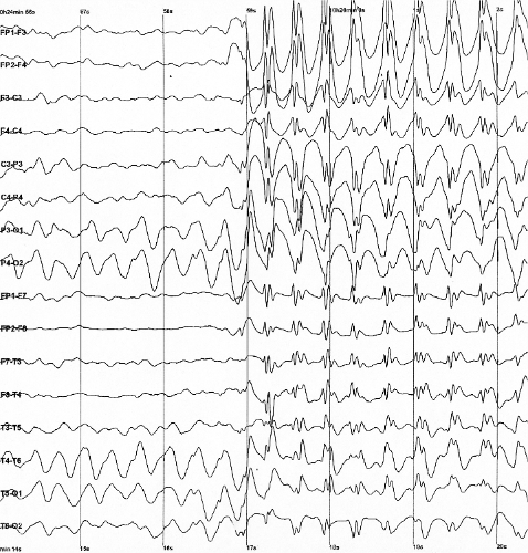 Файл:Spike-waves.png