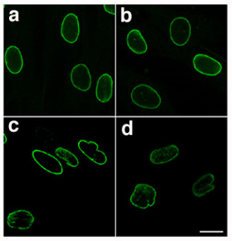 Файл:Laminopathic nuclei.jpg