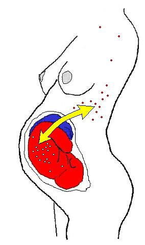Файл:Microchimerism.jpg