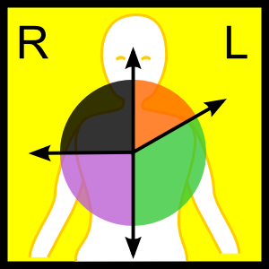 Файл:Axis deviation (ECG).png