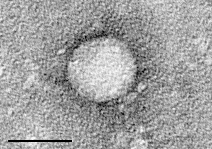 Файл:HCV EM picture 2.png