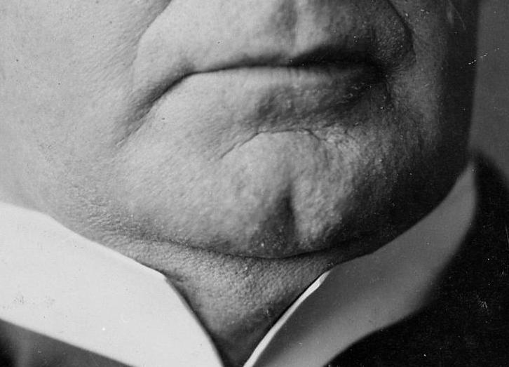 Файл:Cleft-Chin.jpg