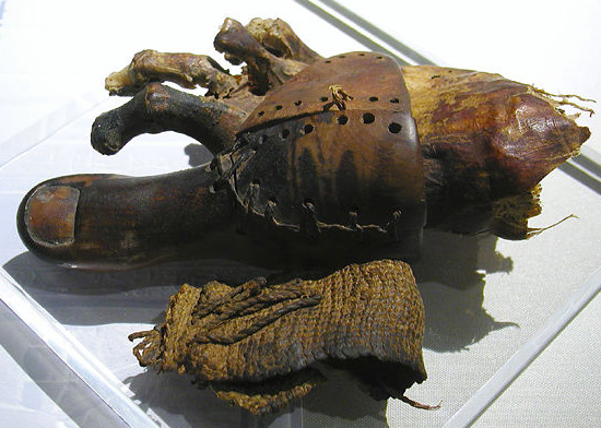 Файл:Prosthetic toe.jpg