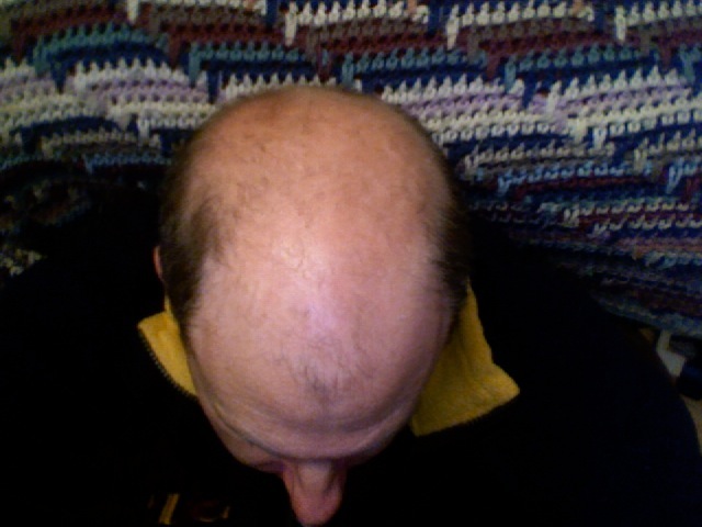 Файл:Bald head.jpg