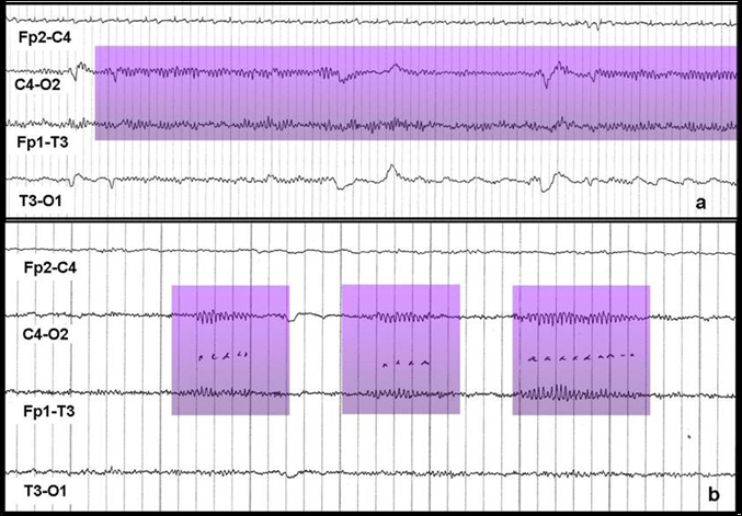 Файл:Mu rhythm.png