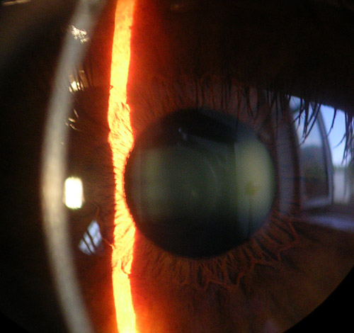 Файл:Cornea.jpg