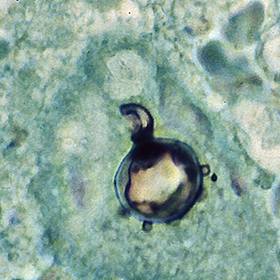 Файл:Paracoccidioides brasiliensis tissue GMS.jpg