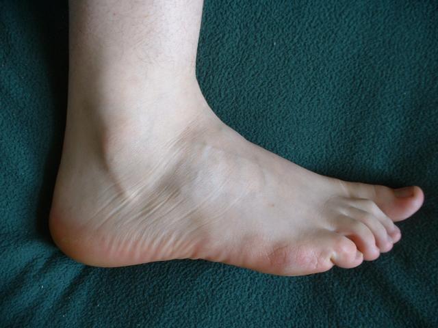 Файл:Foot-outside.jpg