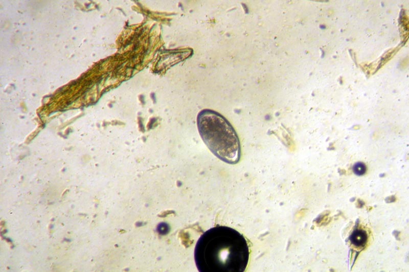 Файл:Haemonchus contortus.jpg