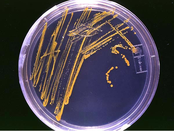 Файл:Agar plate with colonies.jpg