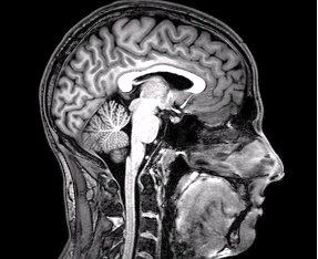 Файл:FMRI Brain Scan.jpg