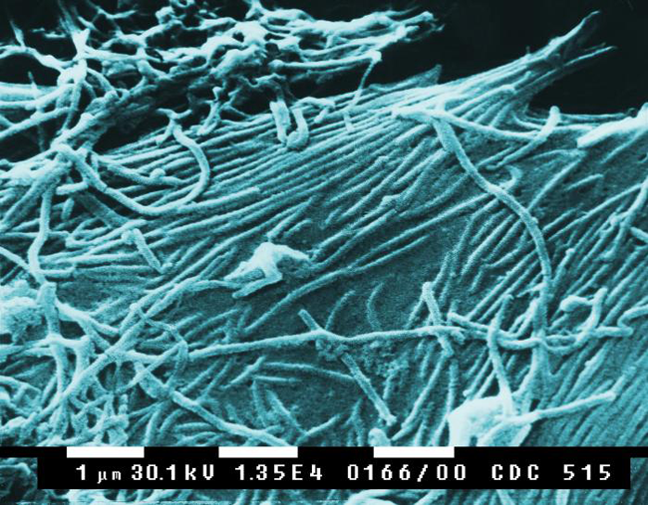 Файл:Ebola virions.png