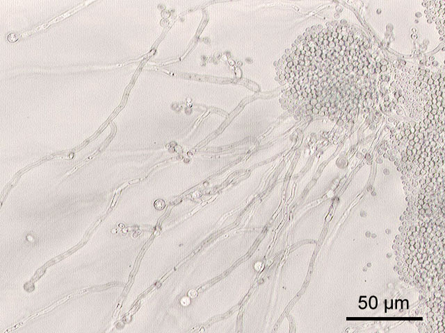Файл:Candida albicans.jpg