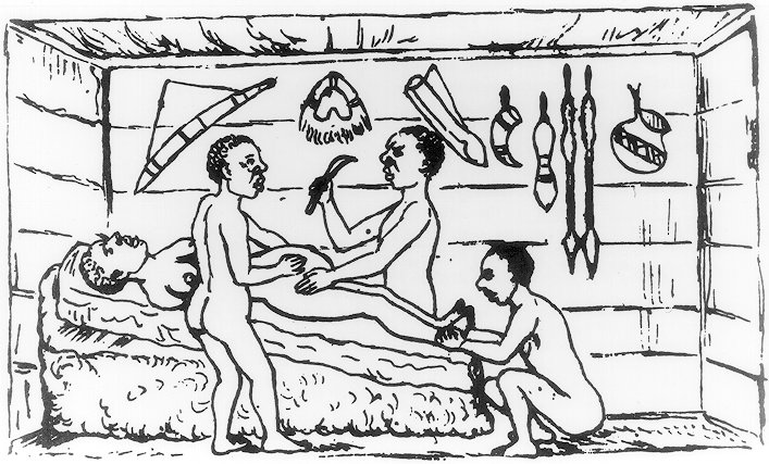 Файл:Uganda cesarean section.gif