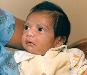 Файл:Baby Fae.jpg