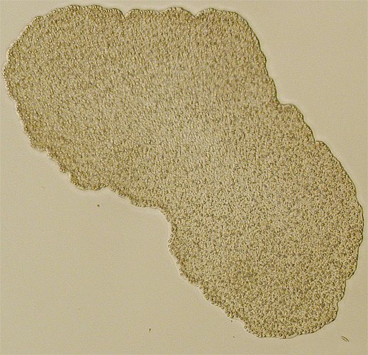 Файл:Trichoplax mic.jpg