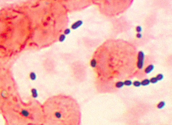 Файл:Enterococcus histological pneumonia 01.png