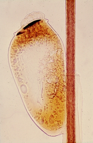 Файл:Head louse egg 2.jpg