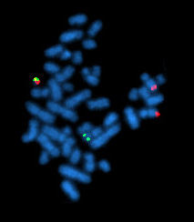 Филадельфийская хромосома, флюоресцентная гибридизация in situ