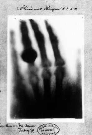 Файл:First medical X-ray by Wilhelm Röntgen of his wife Anna Bertha Ludwig's hand - 18951222.gif