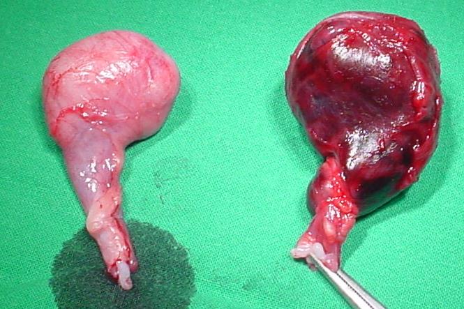 Файл:Hodendrehung Post-OP.jpg