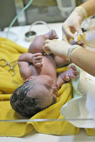 Файл:Umbilical-newborn.jpg