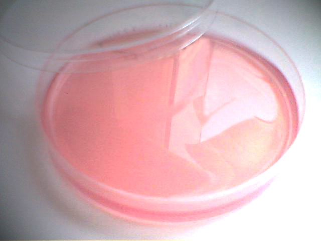 Файл:Endo-Agar.jpg