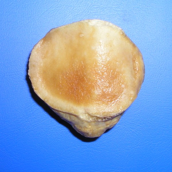 Файл:Patella post.jpg