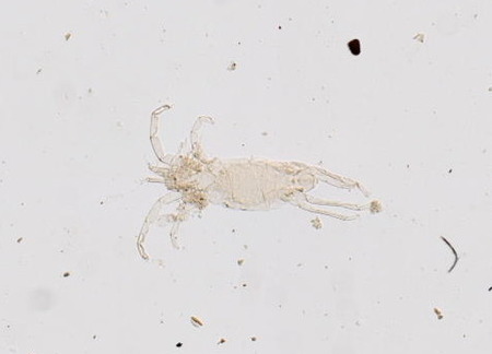 Файл:Anomalohalacarus anomalus (YPM IZ 073661) (cropped).jpeg