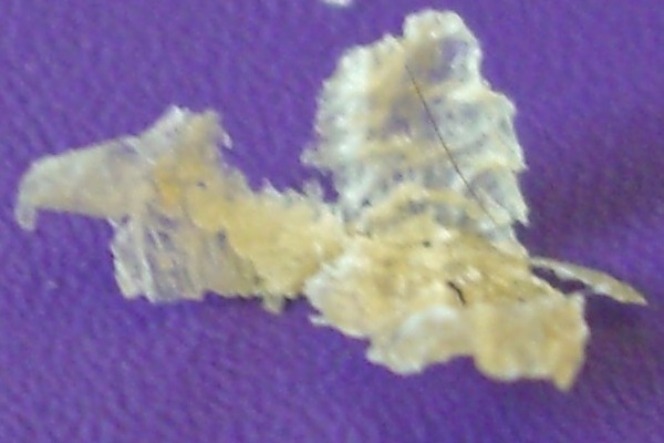 Файл:Dry earwax cropped.jpg
