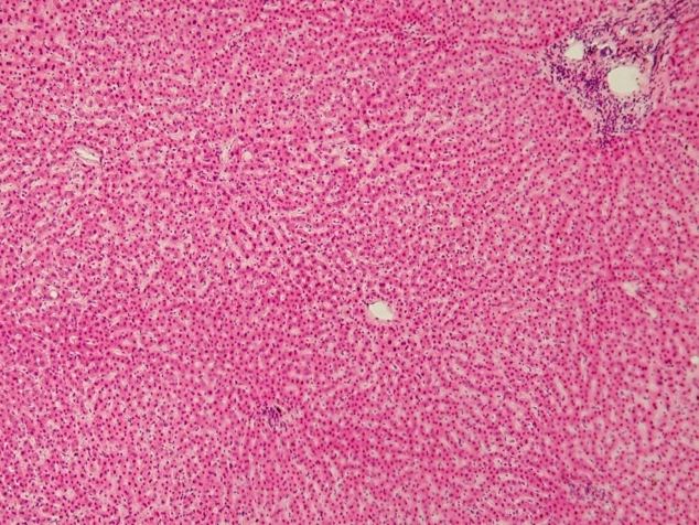 Файл:Human liver.jpg
