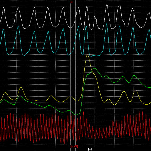 Файл:Polygram1.png
