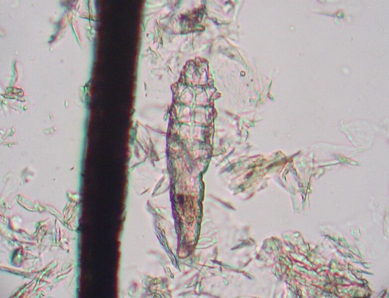 Файл:Demodex mite 1.JPG