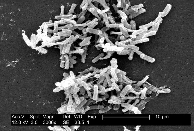 Файл:Clostridium difficile 01.jpg