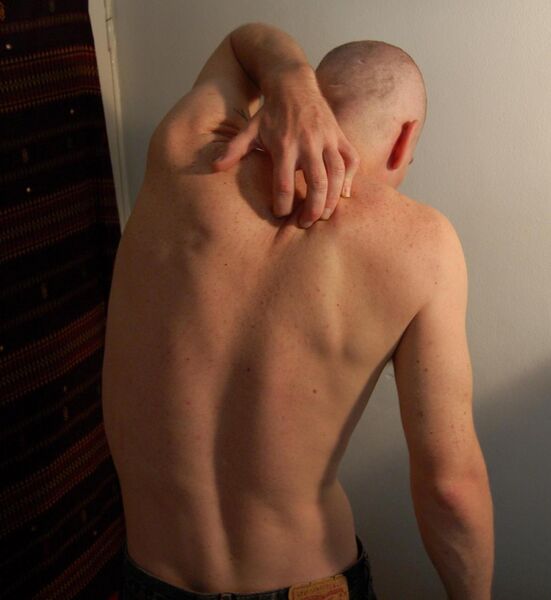 Файл:Itch.jpg