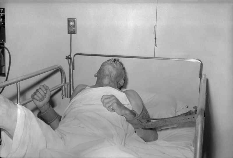 Файл:Rabies patient.jpg