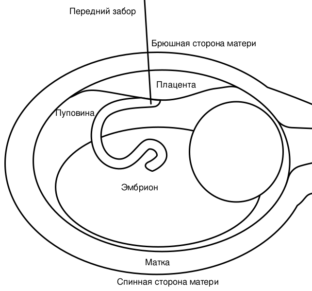 Файл:Anterior Sampling-ru.svg