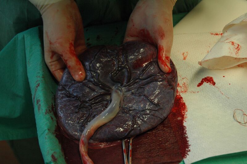Файл:Placenta held.jpg