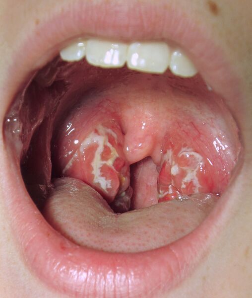 Файл:Pos strep.JPG