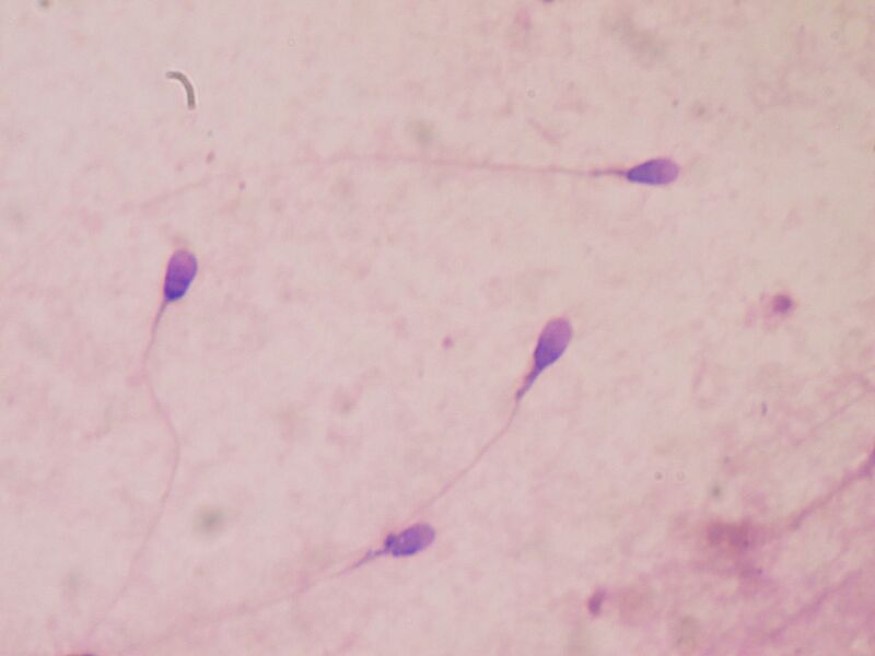 Файл:Sperm stained.JPG