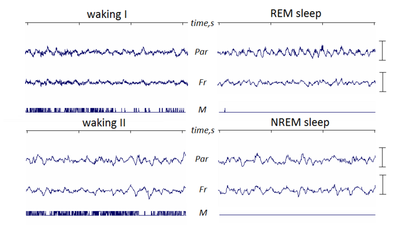 Файл:Normal EEG of mouse.png