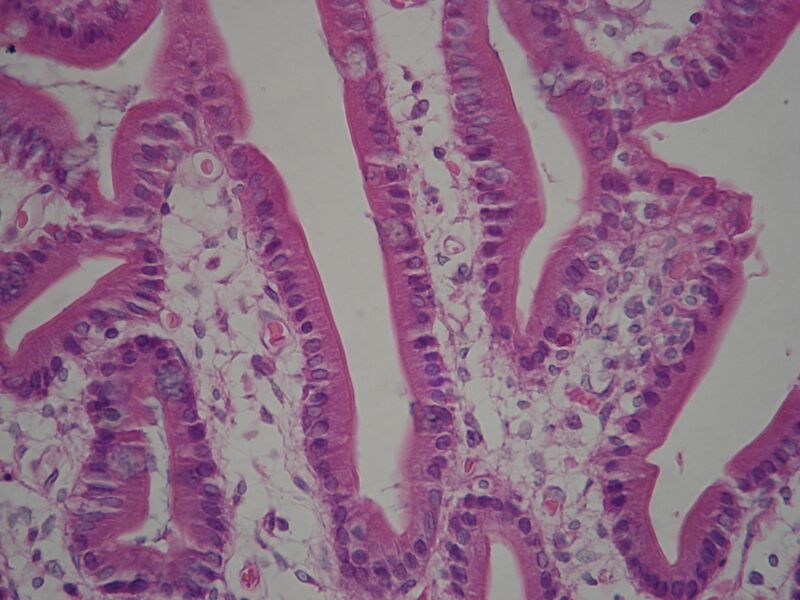 Файл:Microvilli-Duodenum.JPG