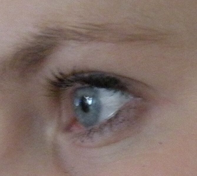 Файл:Blue eye- side.JPG