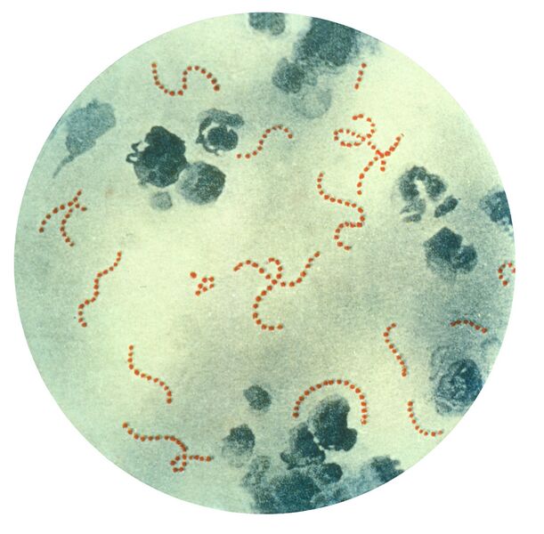 Файл:Streptococcus pyogenes 01.jpg