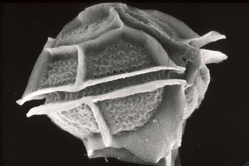 Файл:CSIRO ScienceImage 7608 Pyrodinium.jpg